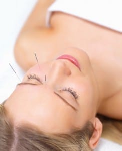 Acupuncture Healing Beautiful Woman
