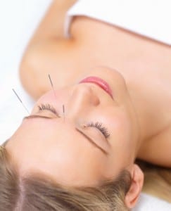 Acupuncture Healing Beautiful Woman Acupuncture Healing Beautiful Woman